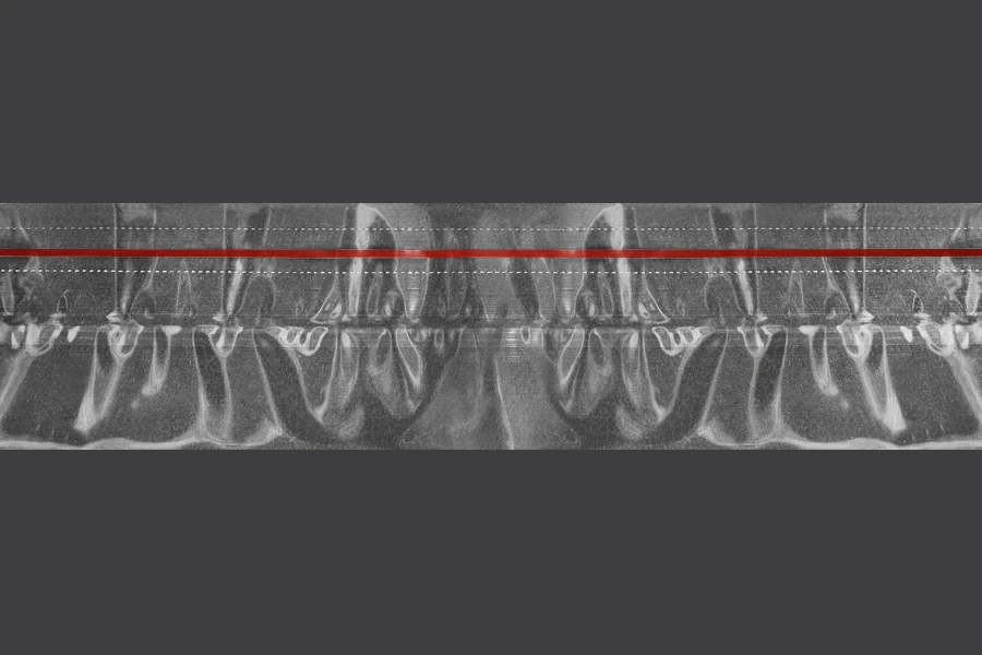 Термосвиваема капсула с ширина 65,8 mm с прорез - Φ 40)-изображение_продукт